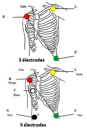 Scope électrodes ECG