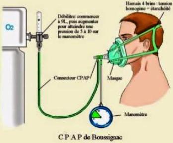 système de Boussignac oxygène