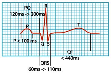 ECG normal