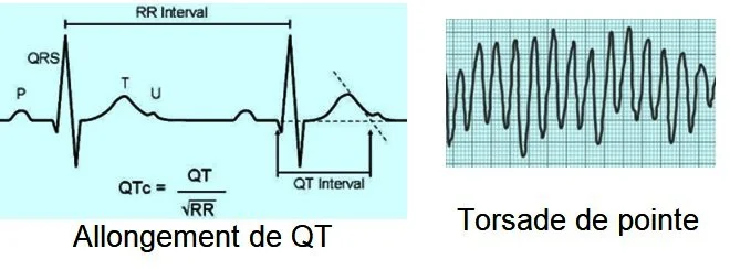 syndromes toxiques cardiotropes et torsade de pointe