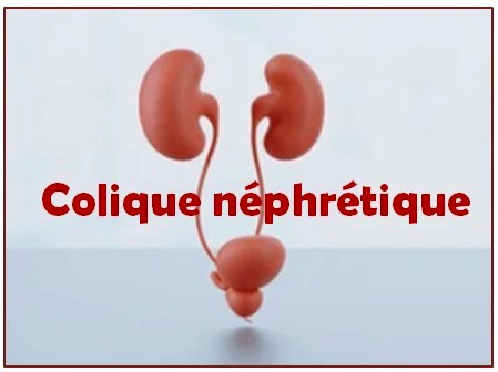 Colique néphrétique