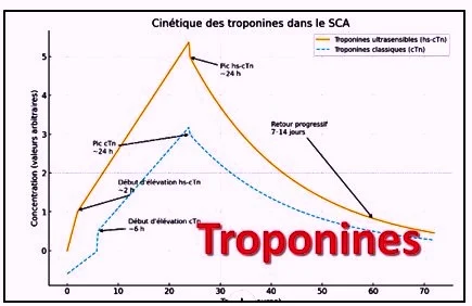 courbe cinétique troponines dans le SCA