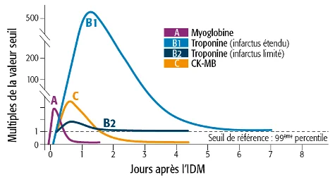 élévation des enzymes dans l'infarctus