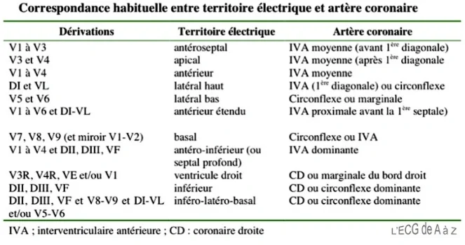 territoire ECG dans le syndrome coronarien