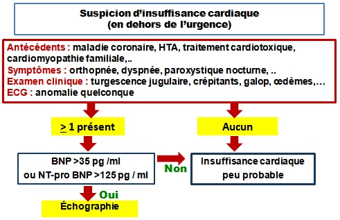 Diagnostic de l'insuffisance cardiaque en ambulatoire