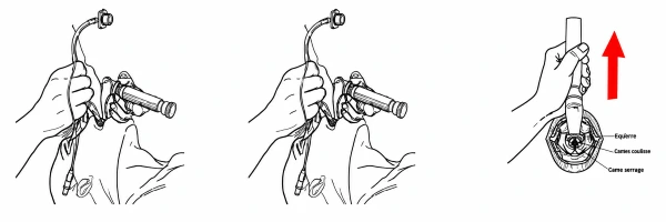 Technique d'intubation trachéale pas à pas Technique d'intubation trachéale pas à pas