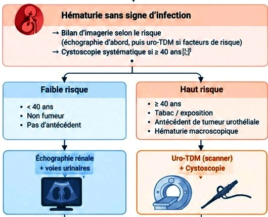 Examens complémentaires pour diagnostic d'hématurie Examens complémentaires pour diagnostic d'hématurie