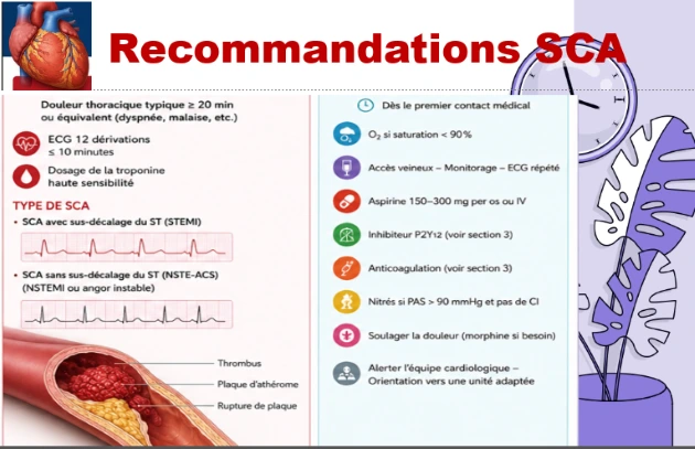 Recommandations sur le traitement du syndrome coronarien aigu Recommandations sur le traitement du syndrome coronarien aigu