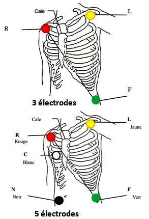 Position des électrodes Scope : position des électrodes