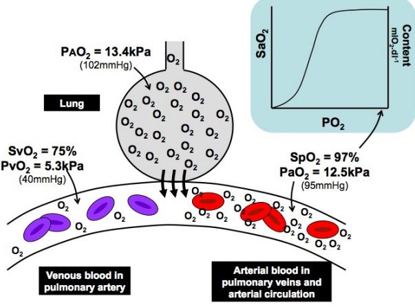 Oxymètre De Pouls, Appareil Numérique Au Doigt Pour Mesurer La Saturation  En Oxygène Dans Le Sang. Une Oxygénation Réduite Est Un Signe D'urgence De  Pneumonie, Par Exemple Causée Par Un Coronavirus. Appareil