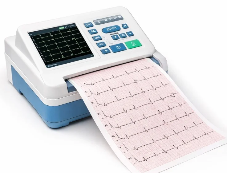 ECG électrocardiogramme