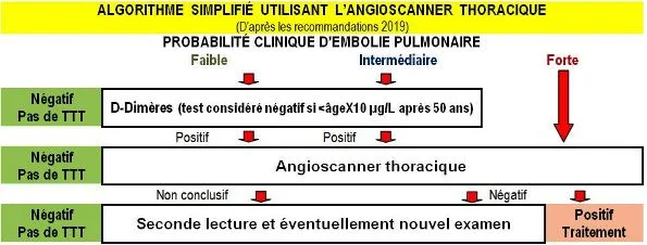 Diagnostic embolie pulmonaire