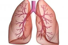 embolie pulmonaire