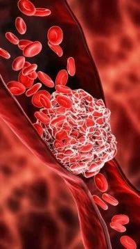 traitement des thromboses
