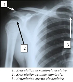 radio épaule Radiographie de l'épaule, anatomie
