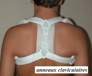 Bandage en huit bandage en huit pour fracture de la clavicule