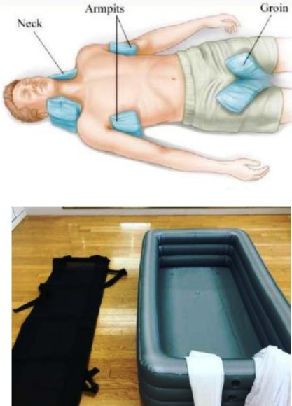 Coup de chaleur, traitement par l'eau froide