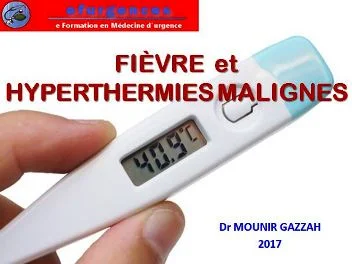 Fièvres et hyperthermies malignes