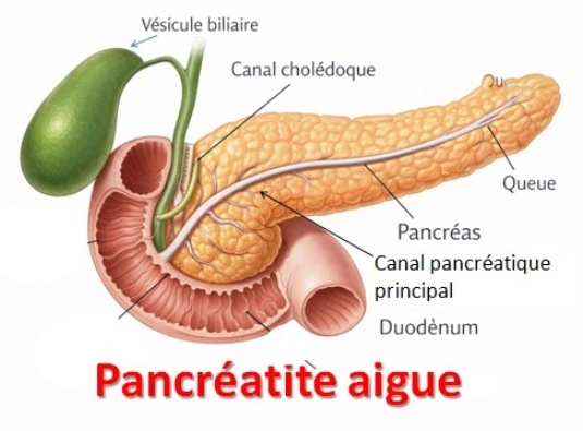 Pancréatite aigue, anatomie