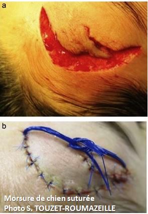 morsure par chien suturée