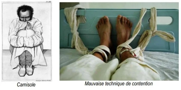 Camisole, conduite à tenir devant l'agitation Camisole, ligoter un patient agité à l'hôpital, conduite à tenir devant l'agitation