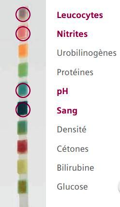 Dépistage de l'infection urinaire par la bandelette urinaire