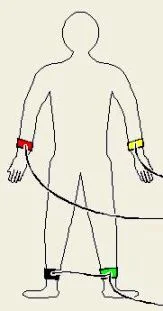 ECG électrocardiogramme position des électrodes