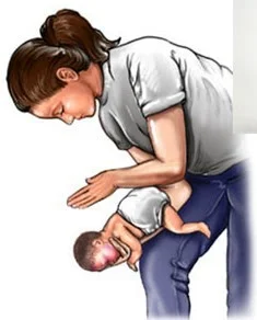 étouffement chez l'enfant Corps étranger chez l'enfant, secourisme