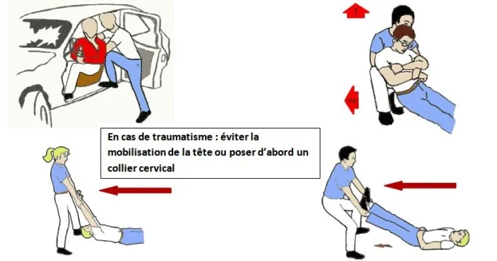 secourisme, dégagement de victime en cas d'accident